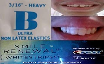ORTHODONTIC GAP TEETH BANDS 3/16 HEAVY WITH WHITE STRIPS AND INTERNATIONAL SHIPPING